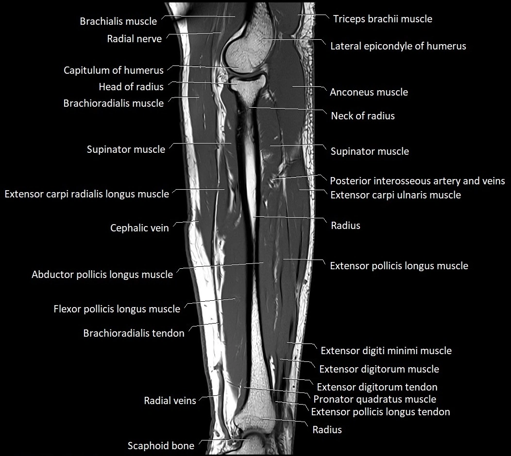 MRI 3T forearm sagittal labelled cross sectional anatomy image 17.webp